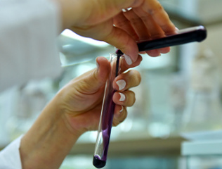 YSU-scientists-create-the-most-ecologically-safe-household-chemicals